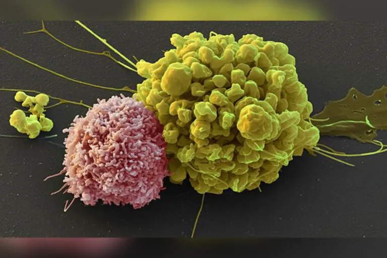 Vědci z Ostravy: Buňky z pupečníkové krve proti rakovině