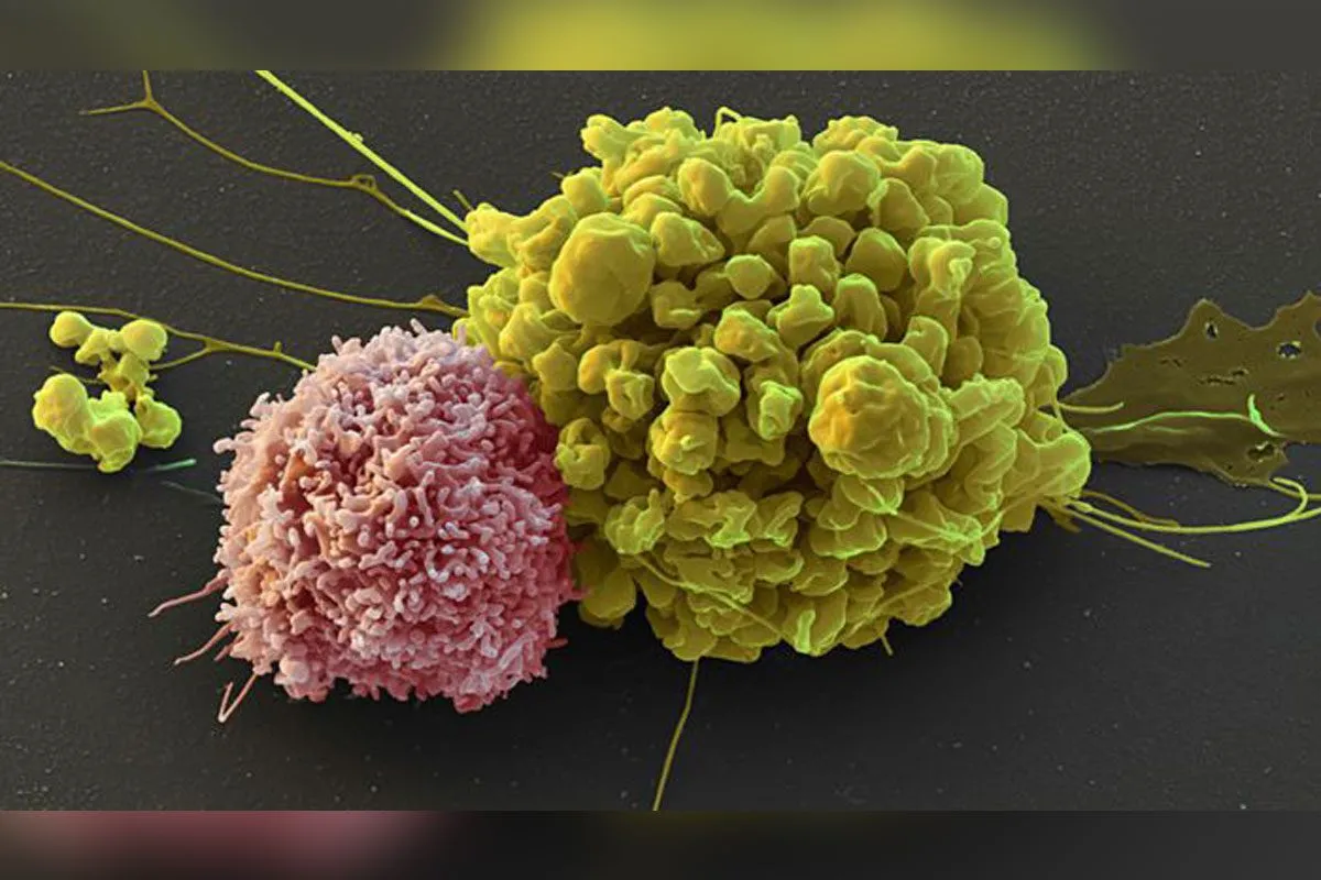 Vědci z Ostravy: Buňky z pupečníkové krve proti rakovině