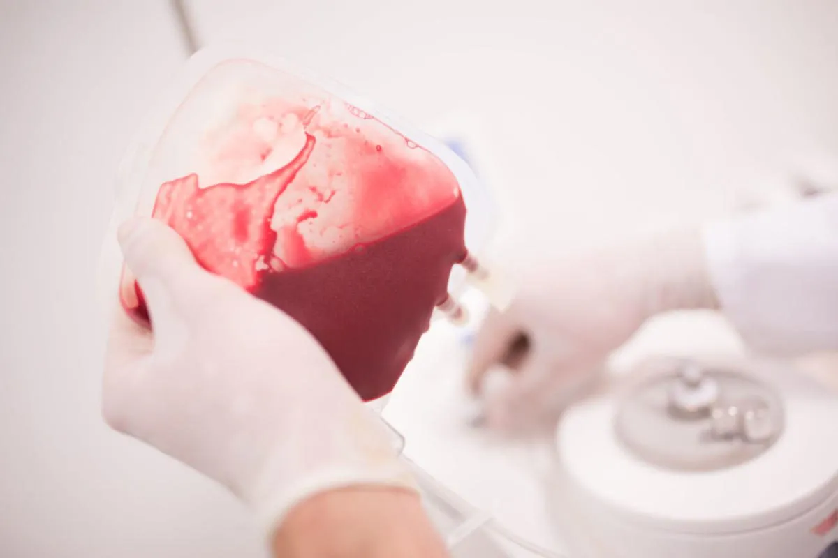 Metaanalýza pupečníkové krve při mozkové obrně naznačuje prospěšnost pupečníkové krve